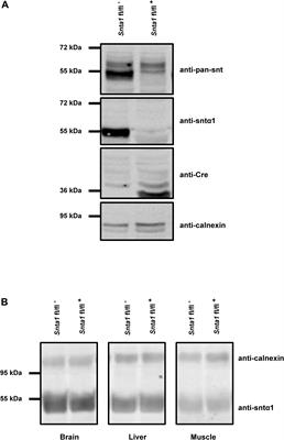 A Distinct Pool of Nav1.5 Channels at the Lateral Membrane of Murine Ventricular Cardiomyocytes